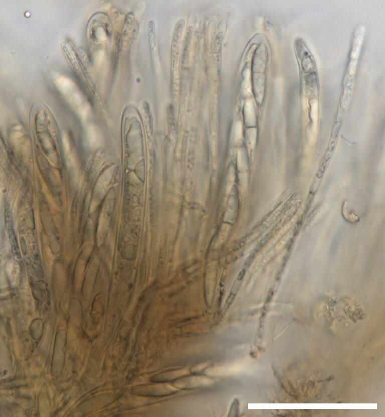 Cyathicula coronata
