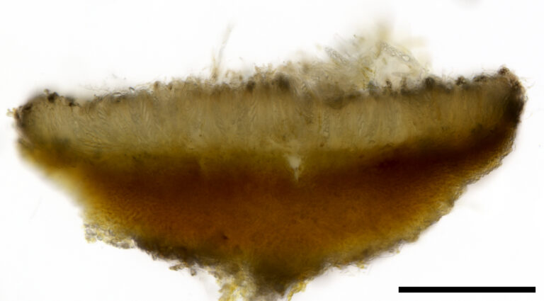 Pezicula sp.